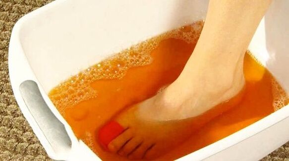 Baño de yodo contra hongos en los pies. 